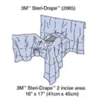 SOLVENTUM GENERAL SURGERY DRAPES